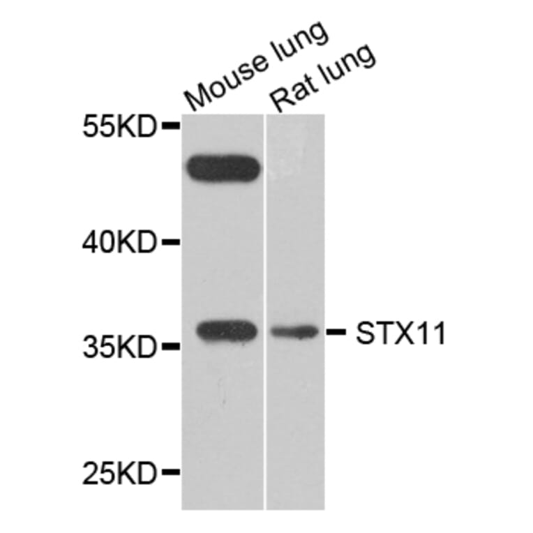 Western Blot - Anti-STX11 Antibody (A8169) - Antibodies.com