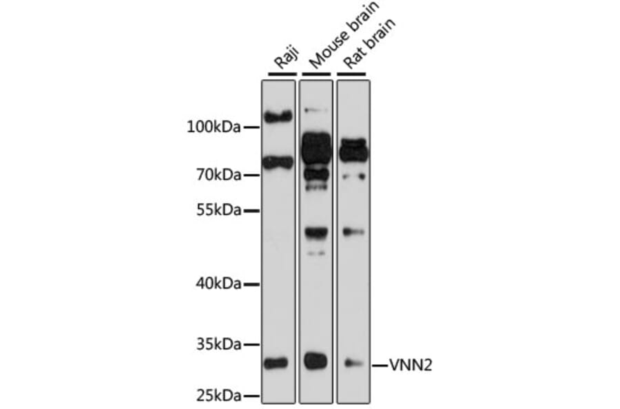 Western Blot - Anti-VNN2 Antibody (A8170) - Antibodies.com