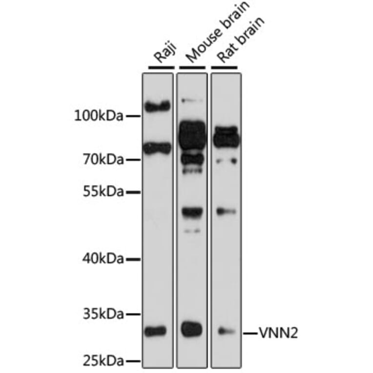 Western Blot - Anti-VNN2 Antibody (A8170) - Antibodies.com
