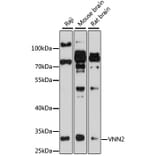 Western Blot - Anti-VNN2 Antibody (A8170) - Antibodies.com