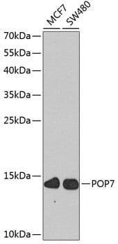 Western blot analysis of extracts of various cell lines, using Anti-POP7 Antibody (A8183) at 1:1,000 dilution.
Secondary antibody: Goat Anti-Rabbit IgG (H+L) (HRP) (AS014) at 1:10,000 dilution.
Lysates / proteins: 25µg per lane.
Blocking buffer: 3% non-fat dry milk in TBST.
Detection: ECL Basic Kit (RM00020).
Exposure time: 90s.