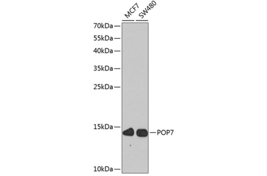 Western Blot - Anti-RPP20 Antibody (A10329) - Antibodies.com