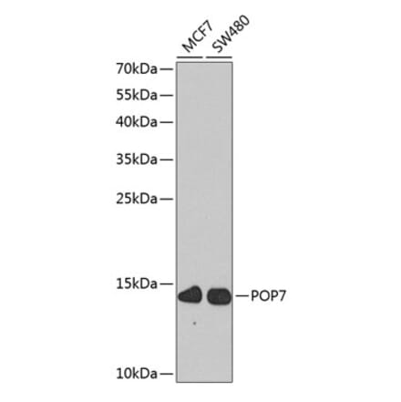 Western Blot - Anti-RPP20 Antibody (A10329) - Antibodies.com