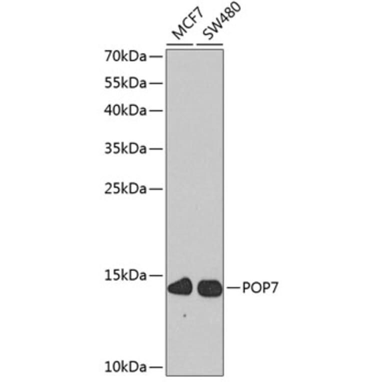 Western Blot - Anti-RPP20 Antibody (A10329) - Antibodies.com