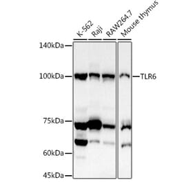 Western Blot - Anti-TLR6 Antibody (A10330) - Antibodies.com