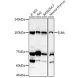 Western Blot - Anti-TLR6 Antibody (A10330) - Antibodies.com