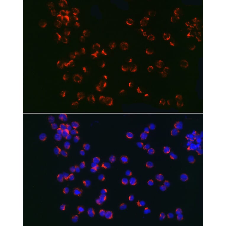 Immunofluorescence - Anti-TLR6 Antibody (A10330) - Antibodies.com