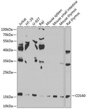 Western blot analysis of extracts of various cell lines, using Anti-CD160 Antibody (A8189) at 1:1,000 dilution.
Secondary antibody: Goat Anti-Rabbit IgG (H+L) (HRP) (AS014) at 1:10,000 dilution.
Lysates / proteins: 25µg per lane.
Blocking buffer: 3% non-fat dry milk in TBST.
Detection: ECL Basic Kit (RM00020).
Exposure time: 90s.
