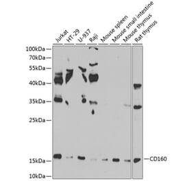 Western Blot - Anti-CD160 Antibody (A10331) - Antibodies.com
