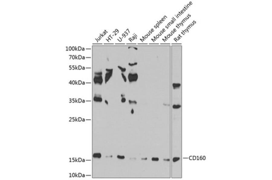 Western Blot - Anti-CD160 Antibody (A10331) - Antibodies.com