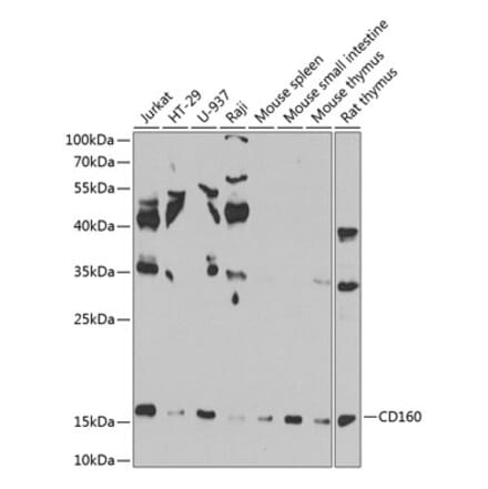 Western Blot - Anti-CD160 Antibody (A10331) - Antibodies.com