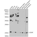 Western Blot - Anti-CD160 Antibody (A10331) - Antibodies.com