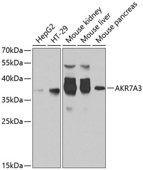 Western blot analysis of extracts of various cell lines, using Anti-AKR7A3 Antibody (A8194) at 1:1,000 dilution.
Secondary antibody: Goat Anti-Rabbit IgG (H+L) (HRP) (AS014) at 1:10,000 dilution.
Lysates / proteins: 25µg per lane.
Blocking buffer: 3% non-fat dry milk in TBST.
Detection: ECL Basic Kit (RM00020).
Exposure time: 30s.
