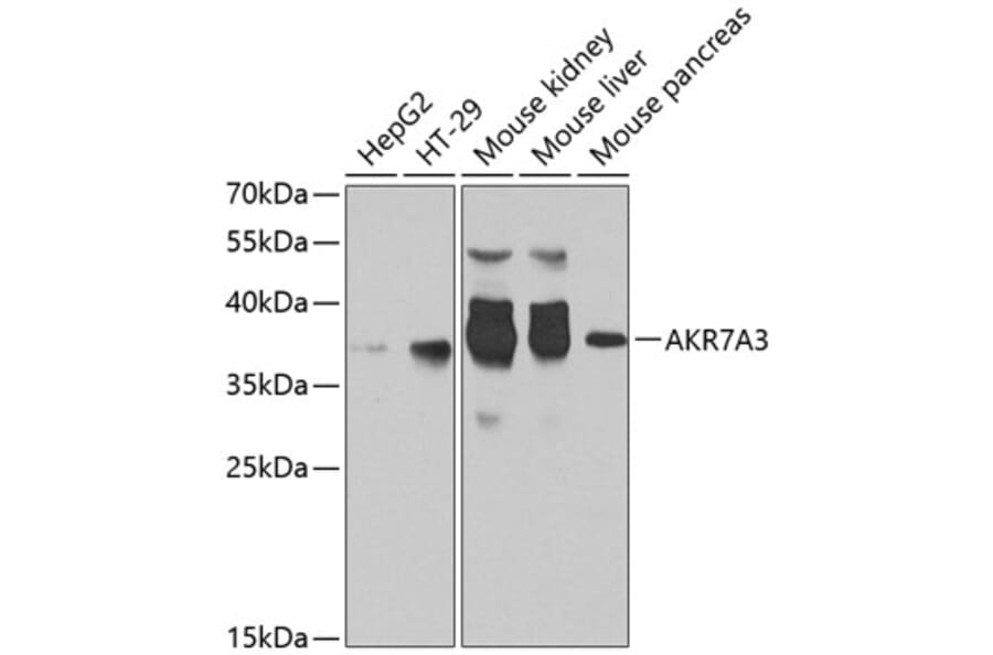 Western Blot - Anti-AKR7A3 Antibody (A10333) - Antibodies.com