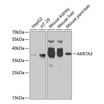 Western Blot - Anti-AKR7A3 Antibody (A10333) - Antibodies.com