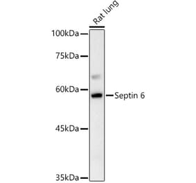 Western Blot - Anti-SEPT6 Antibody (A10334) - Antibodies.com