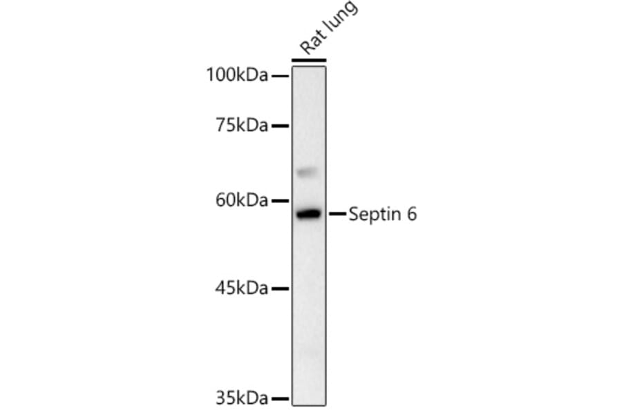 Western Blot - Anti-SEPT6 Antibody (A10334) - Antibodies.com