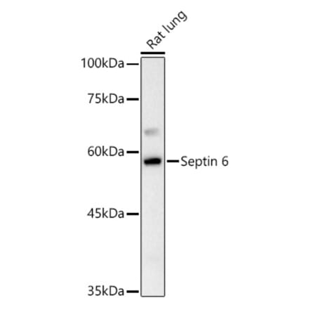 Western Blot - Anti-SEPT6 Antibody (A10334) - Antibodies.com