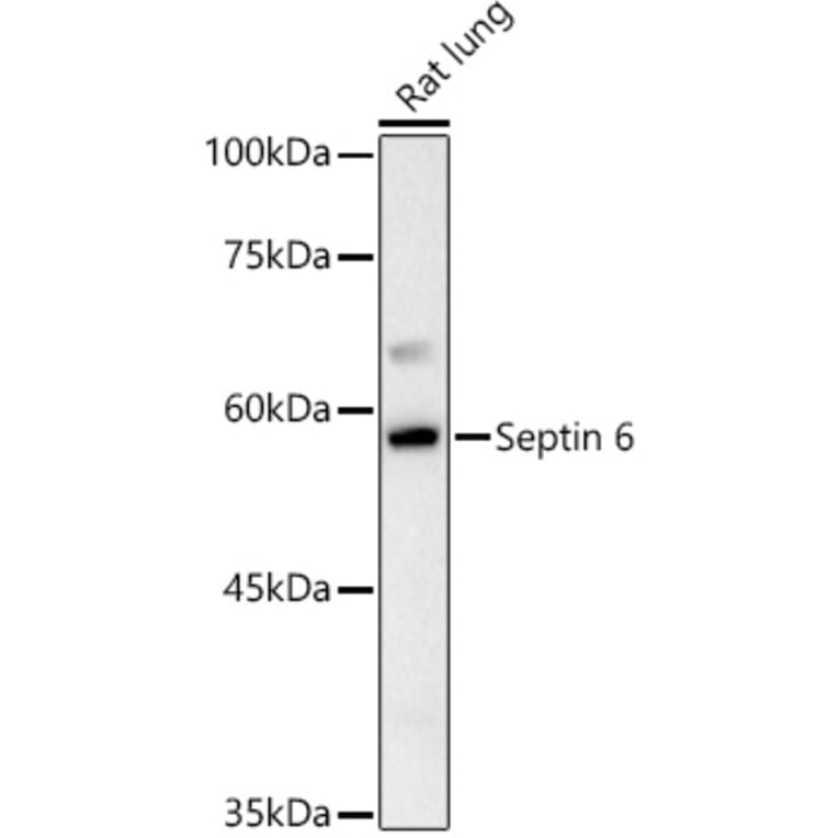 Western Blot - Anti-SEPT6 Antibody (A10334) - Antibodies.com