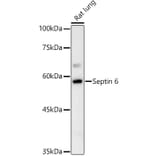 Western Blot - Anti-SEPT6 Antibody (A10334) - Antibodies.com