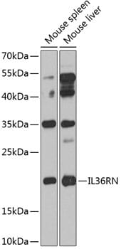 Western blot analysis of extracts of various cell lines, using Anti-IL36RN Antibody (A8205) at 1:1,000 dilution.
Secondary antibody: Goat Anti-Rabbit IgG (H+L) (HRP) (AS014) at 1:10,000 dilution.
Lysates / proteins: 25µg per lane.
Blocking buffer: 3% non-fat dry milk in TBST.
Detection: ECL Enhanced Kit (RM00021).
Exposure time: 60s.
