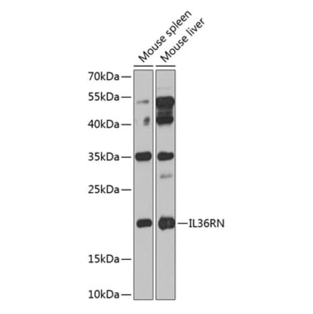 Western Blot - Anti-IL-36RN Antibody (A10335) - Antibodies.com