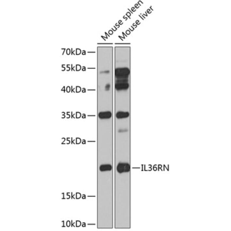 Western Blot - Anti-IL-36RN Antibody (A10335) - Antibodies.com