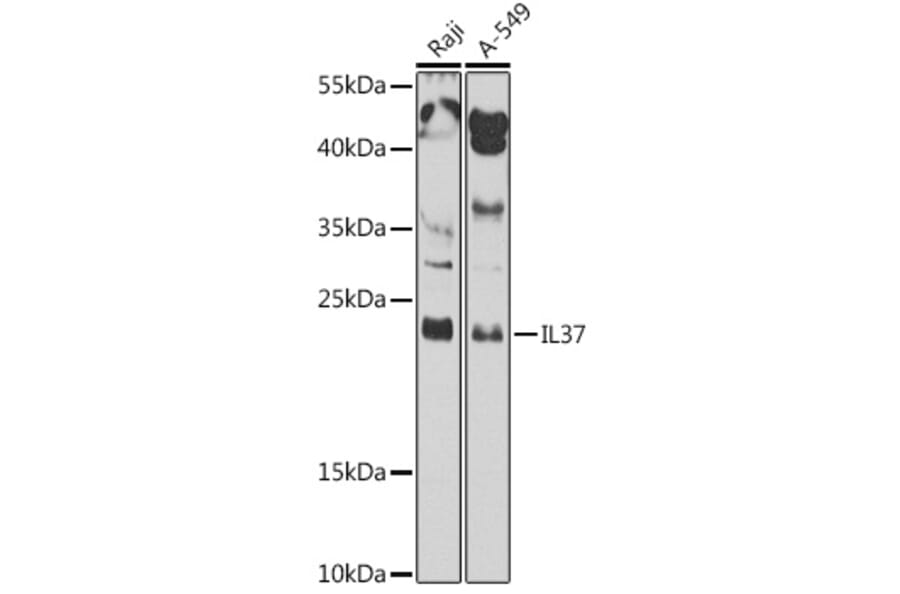 Western Blot - Anti-IL37 Antibody (A10336) - Antibodies.com