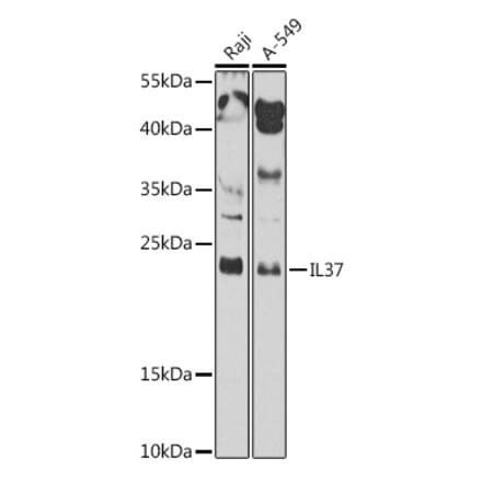 Western Blot - Anti-IL37 Antibody (A10336) - Antibodies.com