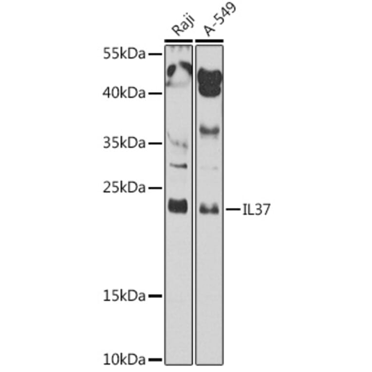 Western Blot - Anti-IL37 Antibody (A10336) - Antibodies.com