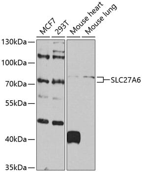 Western blot analysis of extracts of various cell lines, using Anti-SLC27A6 Antibody (A8208) at 1:1,000 dilution.
Secondary antibody: Goat Anti-Rabbit IgG (H+L) (HRP) (AS014) at 1:10,000 dilution.
Lysates / proteins: 25µg per lane.
Blocking buffer: 3% non-fat dry milk in TBST.
Detection: ECL Basic Kit (RM00020).
Exposure time: 90s.