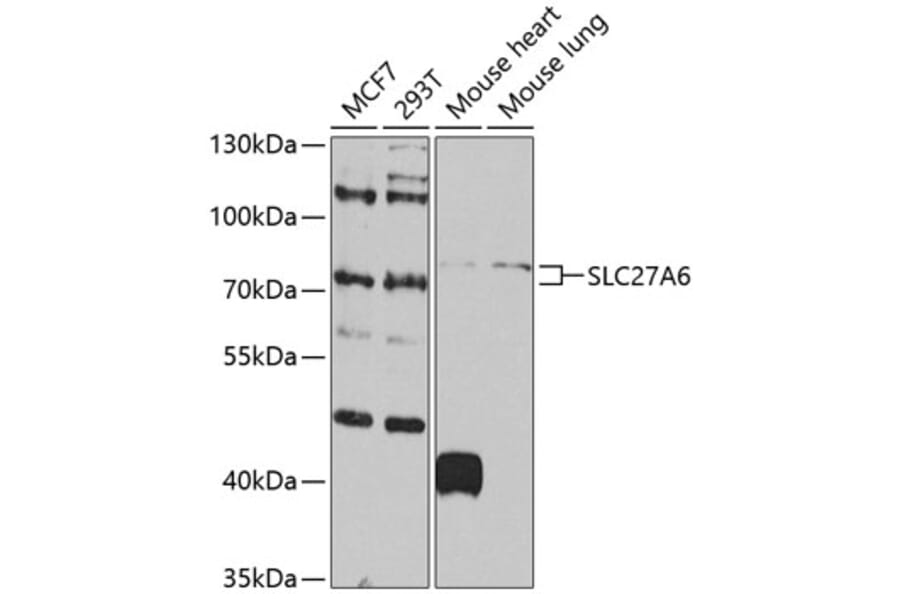 Western Blot - Anti-SLC27A6/FATP6 Antibody (A10337) - Antibodies.com