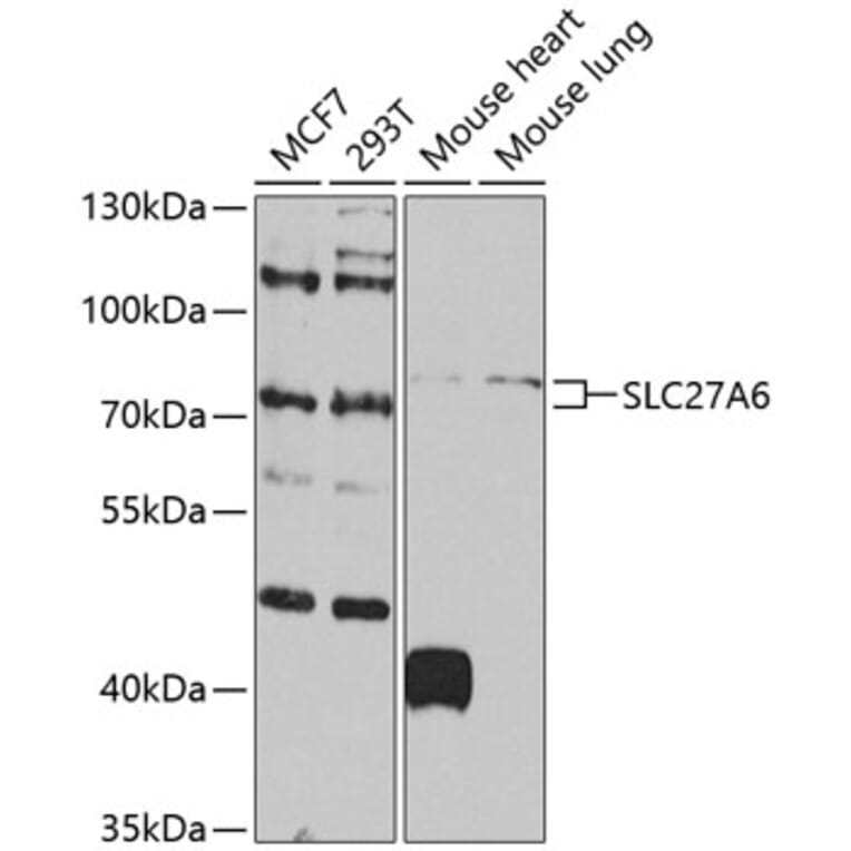 Western Blot - Anti-SLC27A6/FATP6 Antibody (A10337) - Antibodies.com