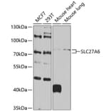 Western Blot - Anti-SLC27A6/FATP6 Antibody (A10337) - Antibodies.com
