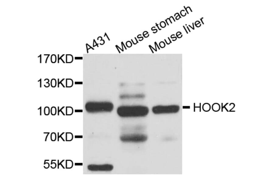 Western Blot - Anti-HOOK2 Antibody (A8210) - Antibodies.com