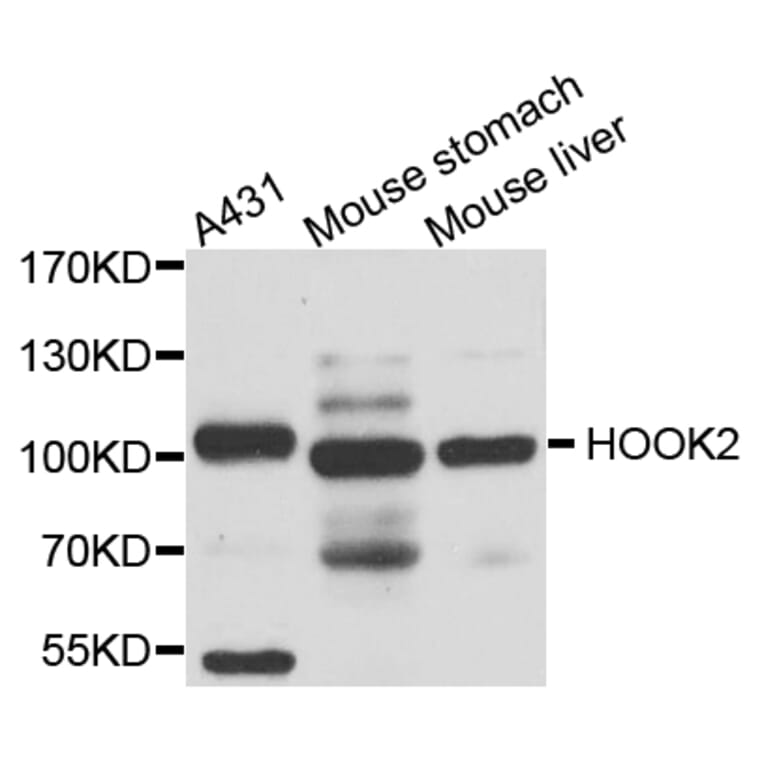 Western Blot - Anti-HOOK2 Antibody (A8210) - Antibodies.com