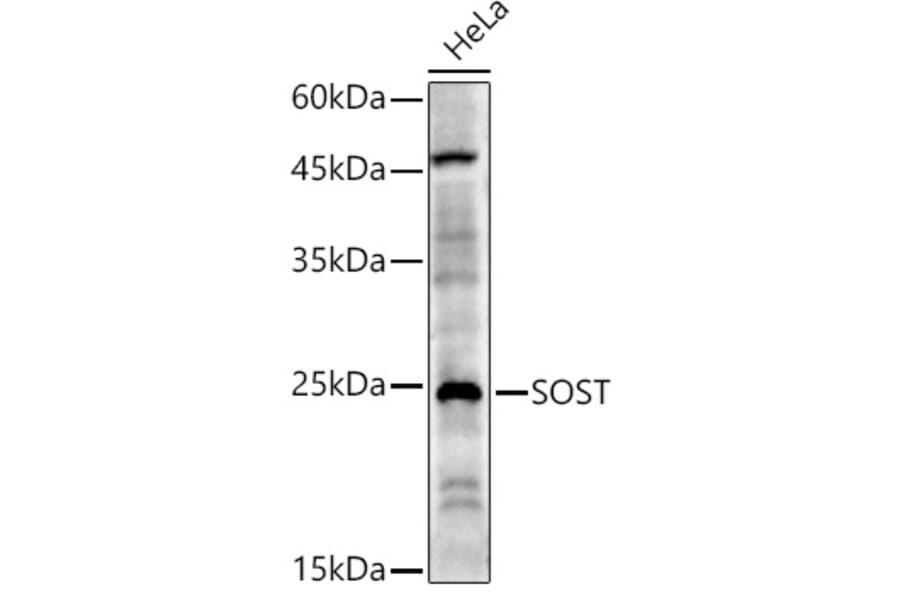 Western Blot - Anti-Sclerostin Antibody (A10341) - Antibodies.com