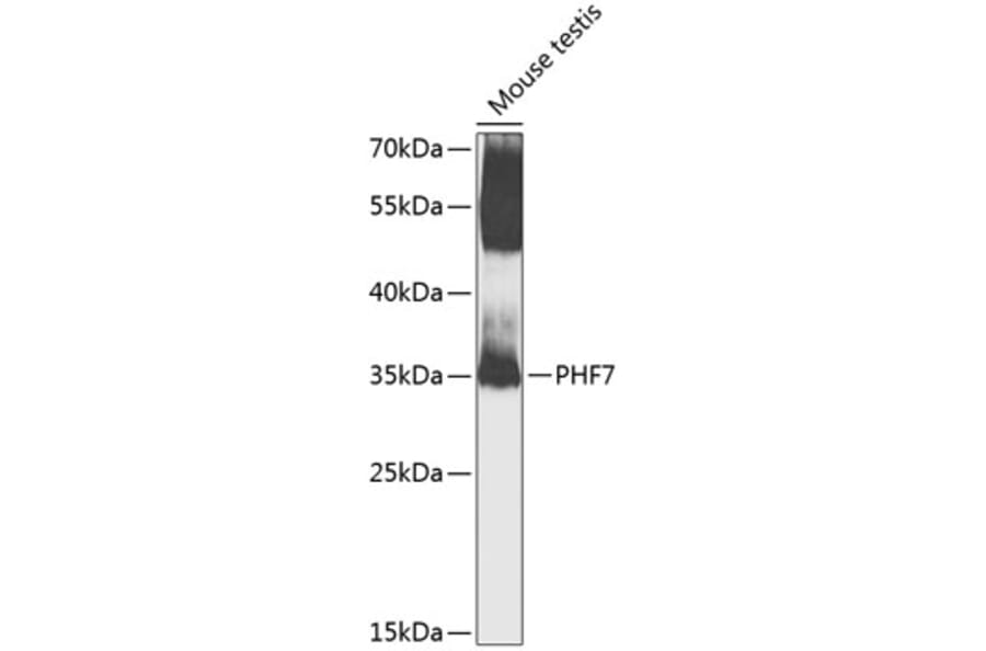 Western Blot - Anti-PHF7 Antibody (A8218) - Antibodies.com