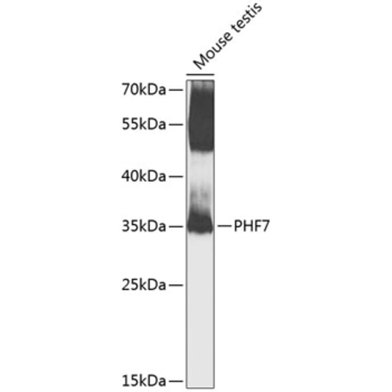 Western Blot - Anti-PHF7 Antibody (A8218) - Antibodies.com