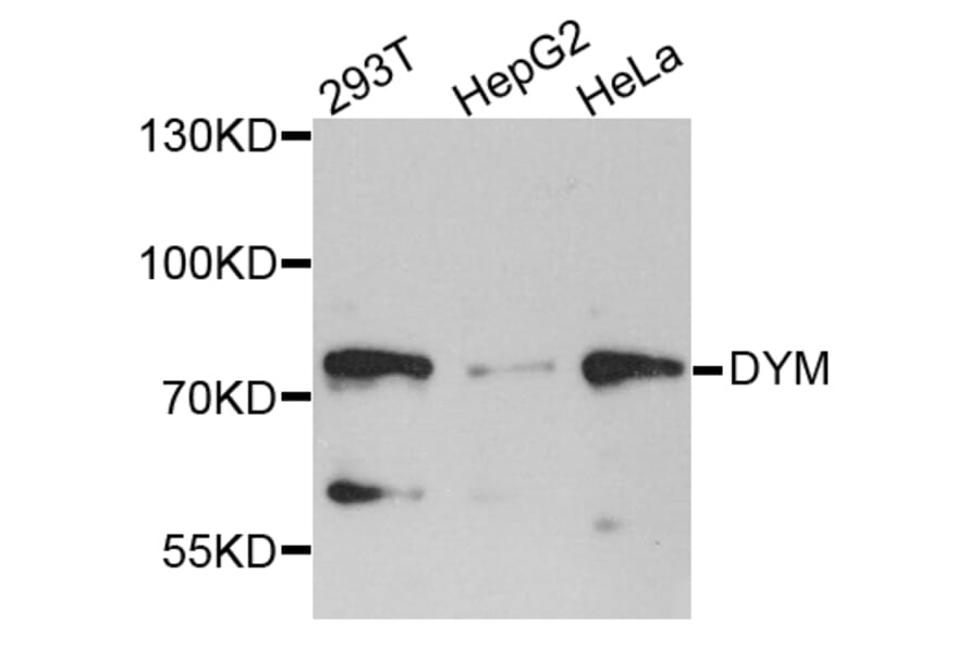 Western Blot - Anti-DYM Antibody (A8222) - Antibodies.com
