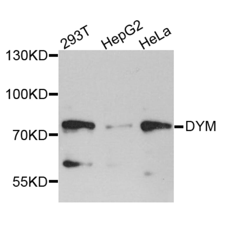 Western Blot - Anti-DYM Antibody (A8222) - Antibodies.com