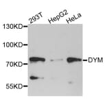 Western Blot - Anti-DYM Antibody (A8222) - Antibodies.com