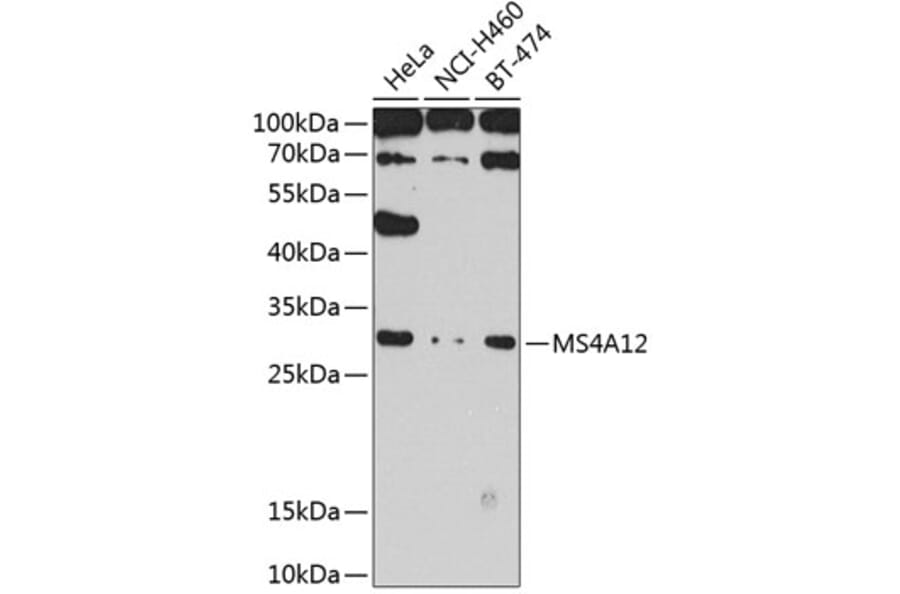 Western Blot - Anti-MS4A12 Antibody (A10349) - Antibodies.com