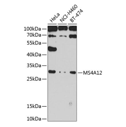 Western Blot - Anti-MS4A12 Antibody (A10349) - Antibodies.com