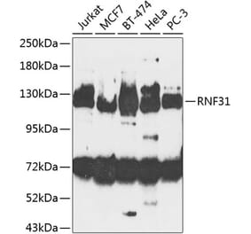 Western Blot - Anti-RNF31/HOIP Antibody (A10351) - Antibodies.com