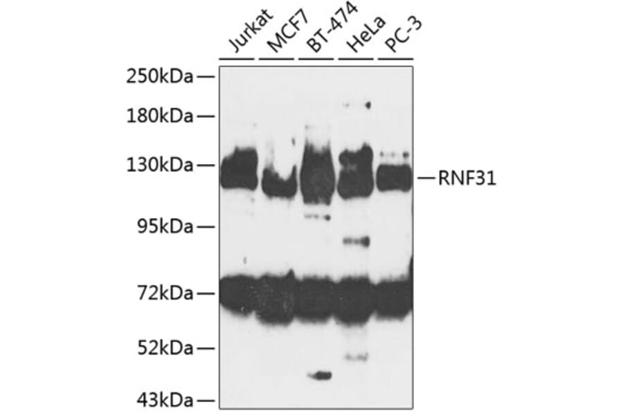 Western Blot - Anti-RNF31/HOIP Antibody (A10351) - Antibodies.com