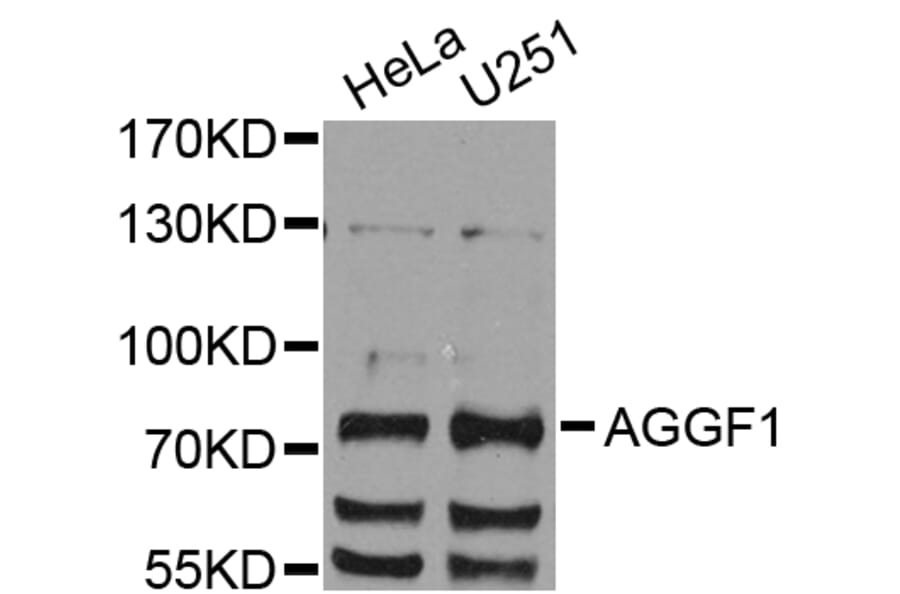 Western Blot - Anti-AGGF1 Antibody (A8228) - Antibodies.com