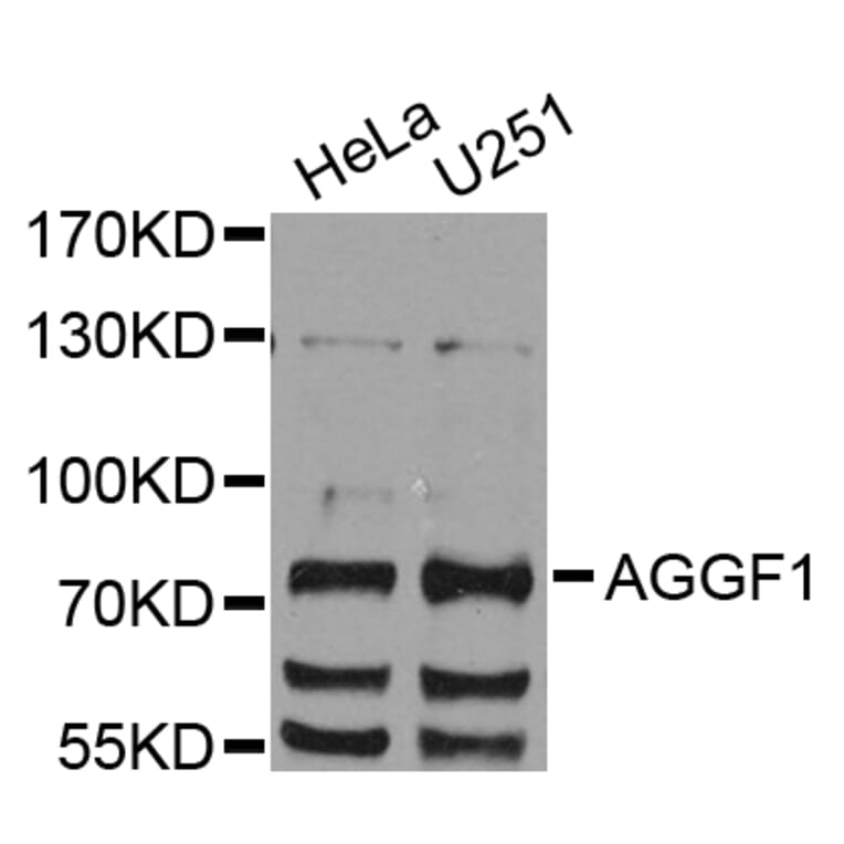 Western Blot - Anti-AGGF1 Antibody (A8228) - Antibodies.com