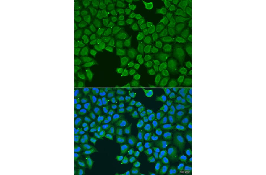 Immunofluorescence - Anti-AGGF1 Antibody (A8228) - Antibodies.com