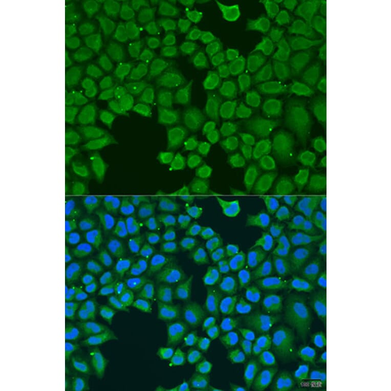 Immunofluorescence - Anti-AGGF1 Antibody (A8228) - Antibodies.com